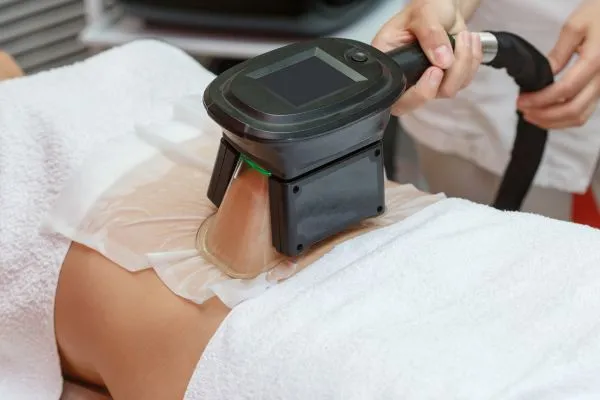 Image of person having fat freezing treatment to help weight gain Bere Regis