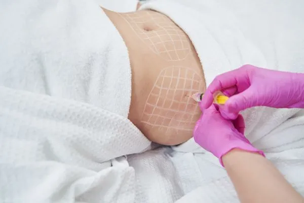 image of fat dissolving injections on love handles to help combat weight gain Bere Regis