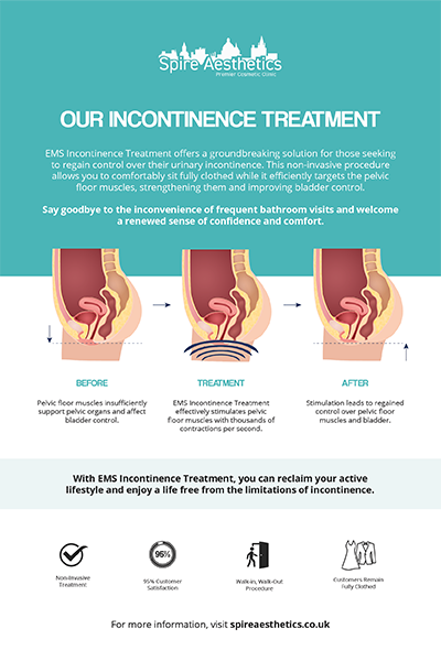 image to show how EMS treatment works for female urinary incontinence Bere Regis